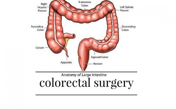 Colorectal Surgery